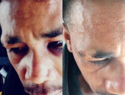 Hajar Korban Hingga Berlumuran Darah, Seorang Warga Sikumana, Kota Kupang Dipolisikan