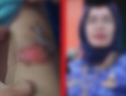ASN Pemprov Sumut diduga siram air panas ke anak tiri