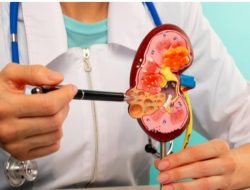 Jangan abaikan, ini 5 gejala ginjal bermasalah yang bisa muncul di pagi hari